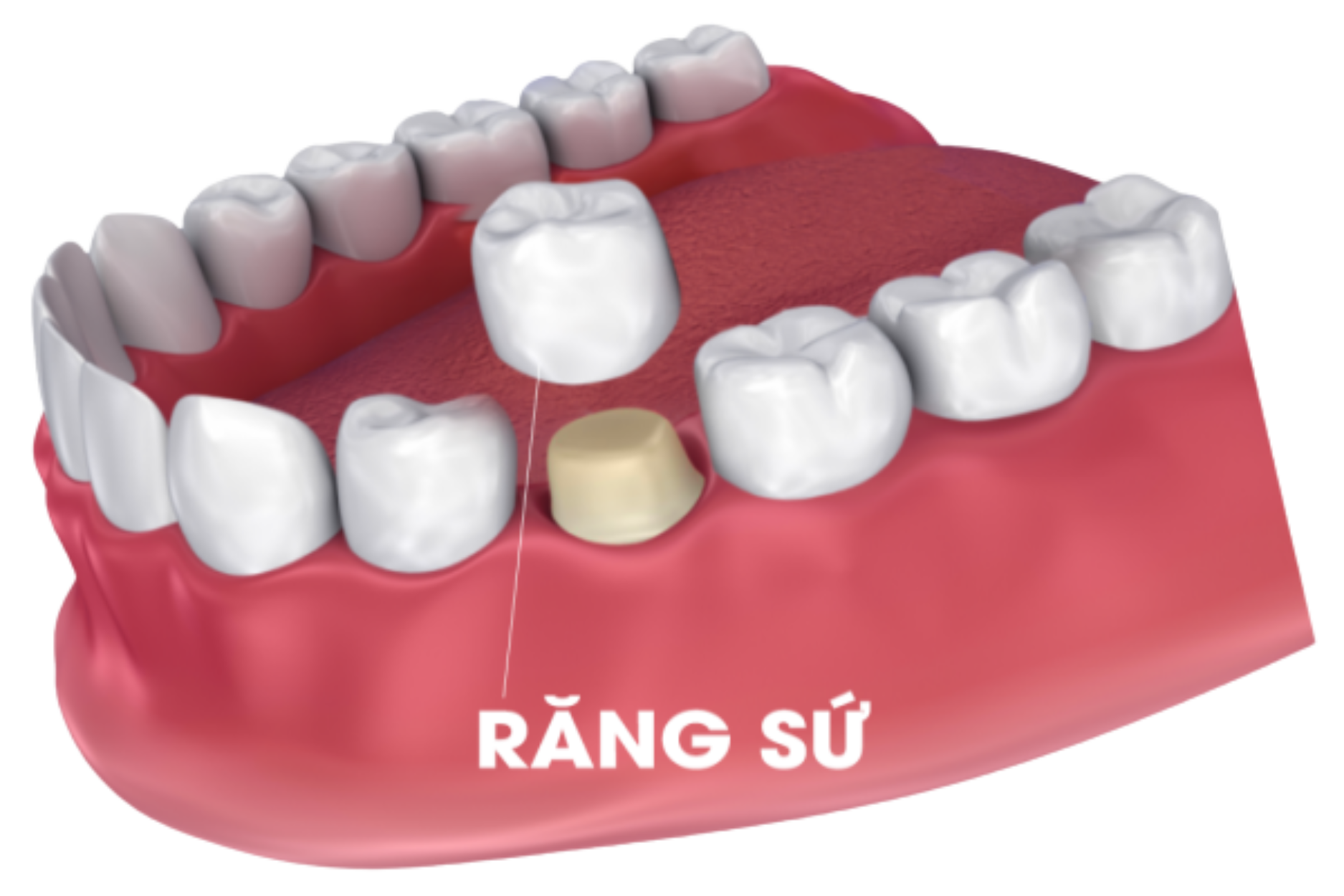 NHA KHOA CỐNG QUỲNH