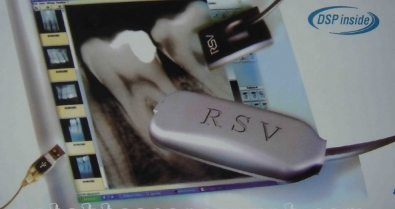 Sensor kỹ thuật số RSV