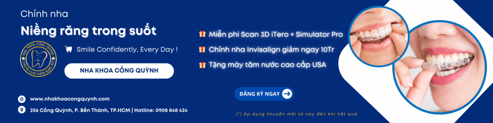 NHA KHOA CỐNG QUỲNH | Nha khoa Quận 1 | Nha khoa TPHCM | Nha khoa Phường Bến Thành
