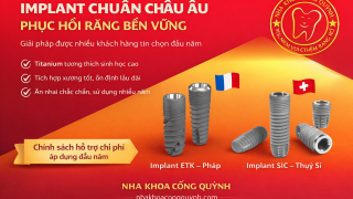 Implant Pháp – Chi phí ưu đãi: Giải pháp tiết kiệm chi phí cho khách hàng