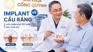 Người sau tuổi 40 nên chọn Implant hay cầu răng