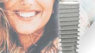 Implant SIC Thụy Sĩ – Giải pháp Implant cao cấp có độ ổn định vượt trội