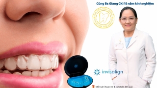 Niềng răng Invisalign – Giải pháp thẩm mỹ, chi phí hợp lý kèm quà tặng hi-tech