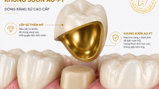 Răng sứ khung sườn Au-Pt – Dòng răng sứ cao cấp