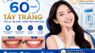 Chỉ 60 phút tẩy trắng: "Độ lại" nụ cười, nâng tầm thần thái