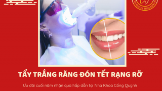 Vì sao nên tẩy trắng răng trước Tết?