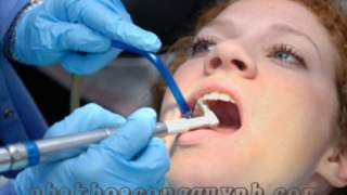 Ý nghĩa của việc Cạo vôi và vệ sinh răng