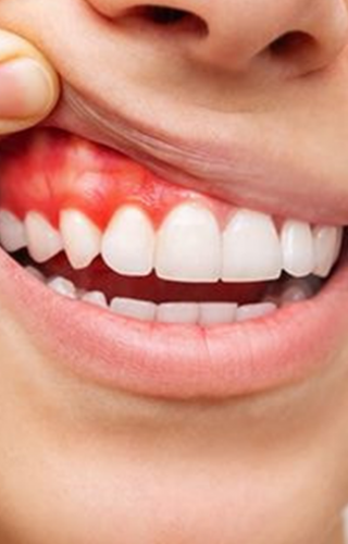 Trước và sau Nha chu