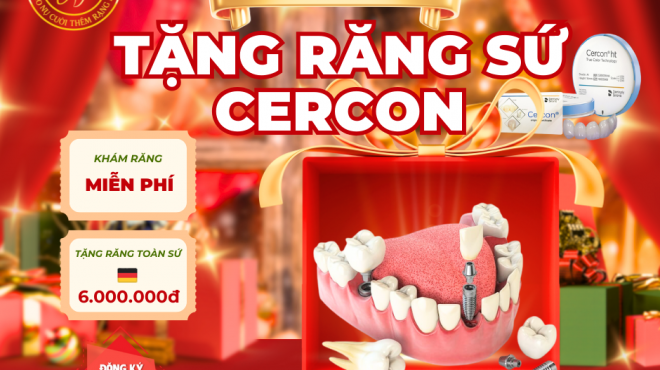 CẮM IMPLANT – TẶNG RĂNG SỨ TOÀN SỨ CERCON ĐỨC
