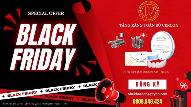 BLACK FRIDAY ƯU ĐÃI ĐẶC BIỆT KHI CẤY GHÉP IMPLANT