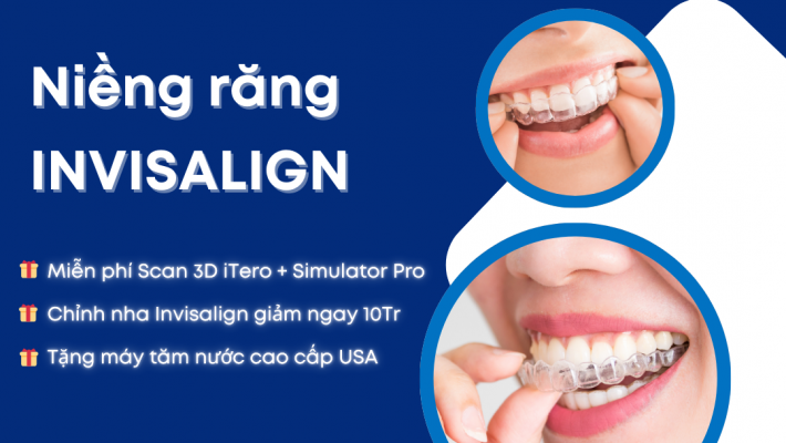 GIẢM NGAY 10 TRIỆU VÀ TẶNG MÁY TĂM NƯỚC KHI NIỀNG RĂNG INVISALIGN – MIỄN PHÍ SCAN 3D iTERO 