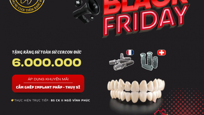 BLACK FRIDAY ƯU ĐÃI ĐẶC BIỆT CHO DỊCH VỤ CẤY GHÉP IMPLANT