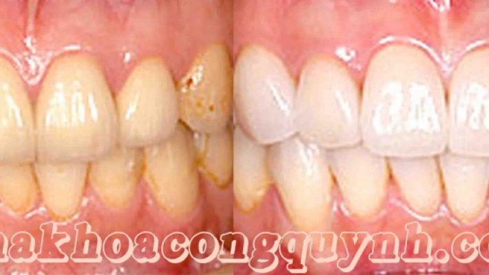 Các câu hỏi thường gặp