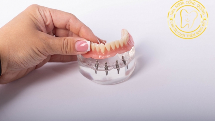 Trồng Implant có đau không? 