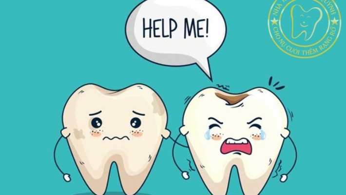 Dấu hiệu sâu răng sữa mà ba mẹ dễ bỏ qua