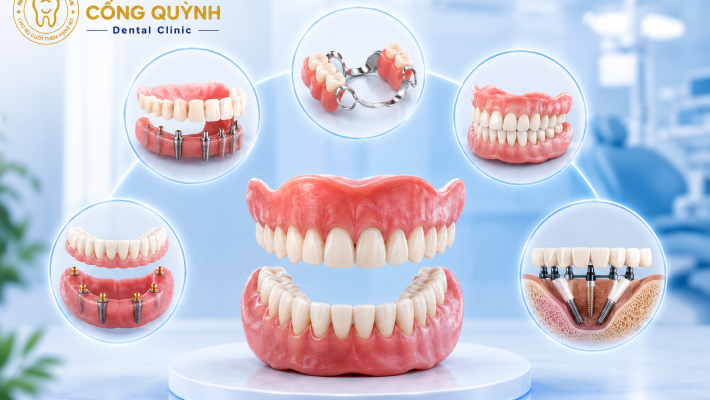 Mất răng toàn hàm có những giải pháp phục hình nào ?
