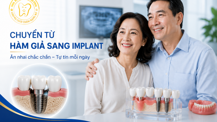 Vì sao nhiều người trung niên chuyển từ hàm giả sang Implant