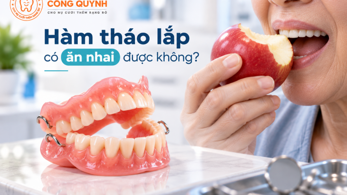 Hàm tháo lắp có ăn nhai được không?