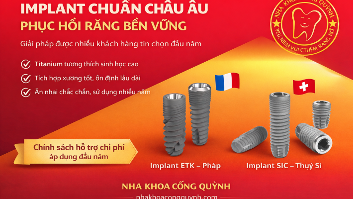 Implant Pháp – Chi phí ưu đãi: Giải pháp tiết kiệm chi phí cho khách hàng