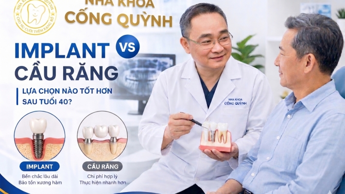 Người sau tuổi 40 nên chọn Implant hay cầu răng