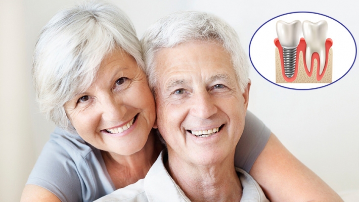 Khách hàng cấy ghép implant chia sẻ: “Tôi đã trồng Implant và thấy mình trẻ lại”