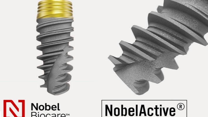 IMPLANT MỸ – VÌ SAO LUÔN ĐƯỢC ĐÁNH GIÁ CAO TRONG PHỤC HÌNH RĂNG MẤT?