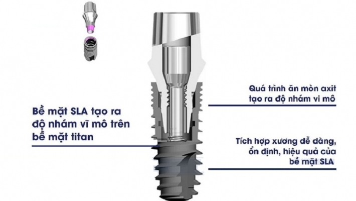 Implant Kontact, Tekka, EuroTeknika, ...(Pháp)