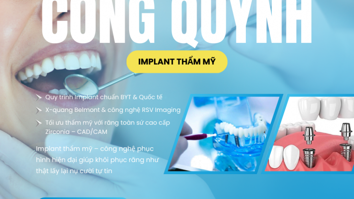 Nha Khoa Cống Quỳnh – Chuyên gia phục hình Implant thẩm mỹ