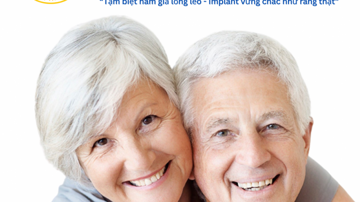 Trồng răng Implant – Giải pháp phục hồi răng mất cho người trung niên