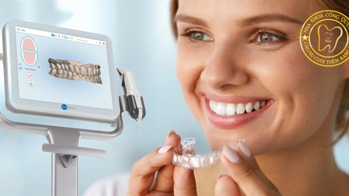 iTero & Invisalign – Bộ đôi vàng trong chỉnh nha thẩm mỹ hiện đại