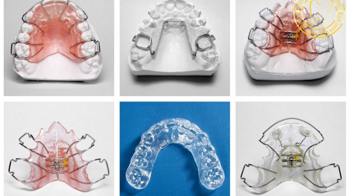 Khí cụ tháo lắp