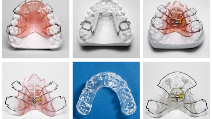 Khí cụ tháo lắp