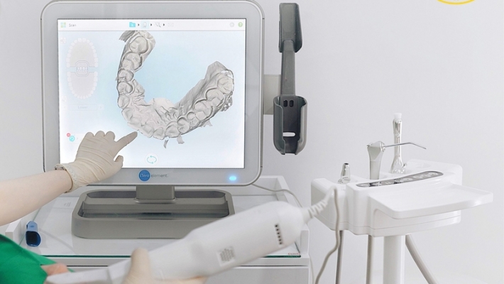Nha khoa Quận 1 có máy scan iTero – Công nghệ chỉnh nha Invisalign hiện đại