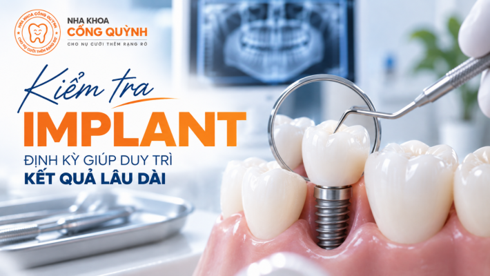 Kiểm tra Implant định kỳ giúp duy trì kết quả lâu dài