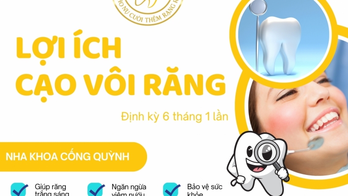 Cạo vôi răng định kỳ: Tại sao quan trọng và bao lâu nên thực hiện?