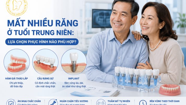 Mất nhiều răng ở tuổi trung niên: lựa chọn phục hình nào phù hợp