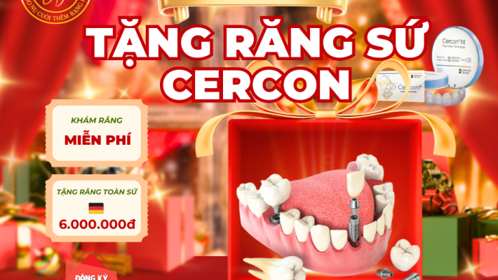 CẮM IMPLANT – TẶNG RĂNG SỨ TOÀN SỨ CERCON ĐỨC