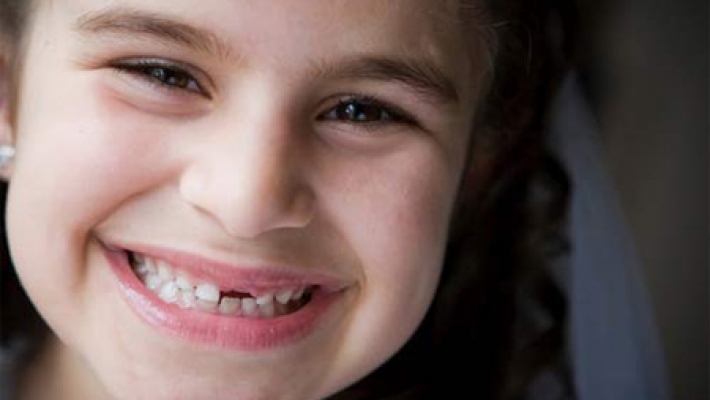 Một số lưu ý khi trẻ thay răng