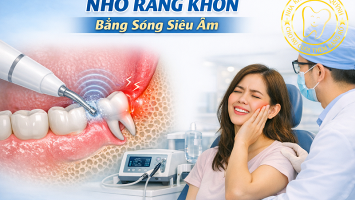 Nhổ răng khôn bằng sóng siêu âm – ít đau, nhanh lành