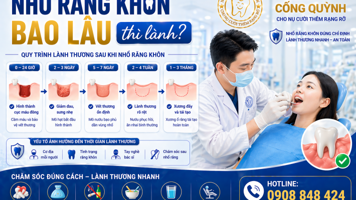 Nhổ răng khôn bao lâu thì lành? Cách giảm đau nhanh nhất