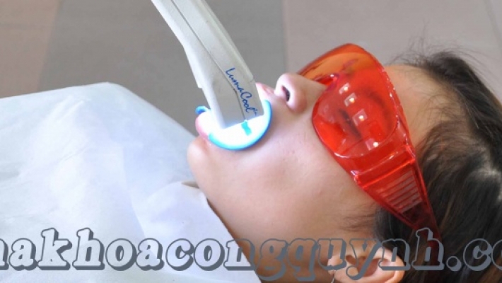 Những điều cần biết sau khi tẩy trăng răng