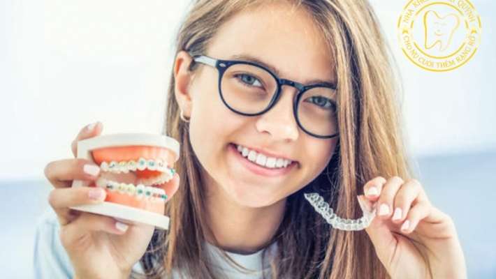 Chỉnh nha sớm đầu năm – rút ngắn hành trình đẹp sau này