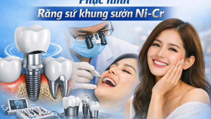 Phục hình Răng sứ khung sườn Ni-Cr