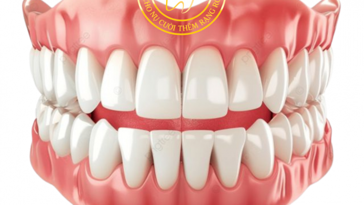 Hàm giả bị lỏng – nguyên nhân và cách khắc phục