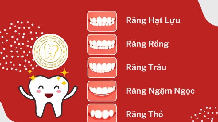 5 tiêu chí chọn dáng răng sứ phù hợp với khuôn mặt và phong thủy