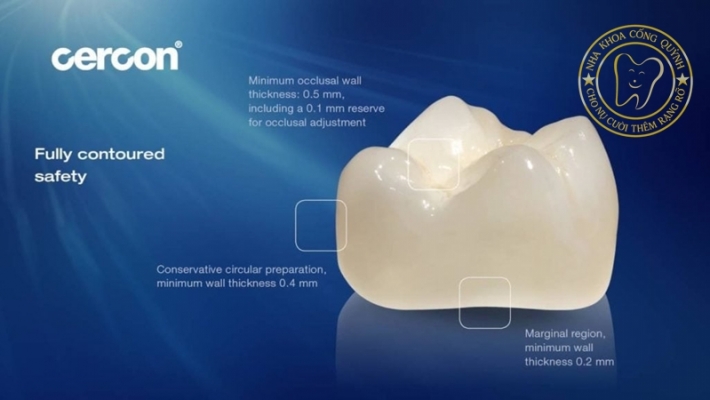 Răng sứ Cercon Đức tại TP.HCM – Thẩm mỹ và bền chắc