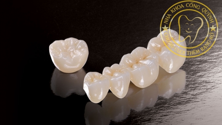 RĂNG SỨ LÀ GÌ ?