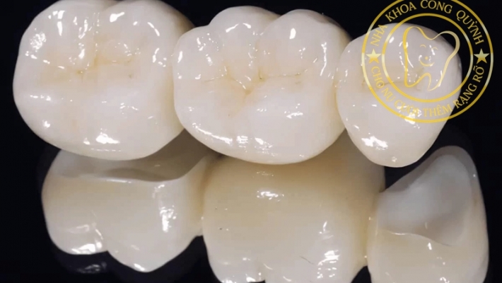 Bọc răng sứ thẩm mỹ: Có ảnh hưởng đến răng thật không?