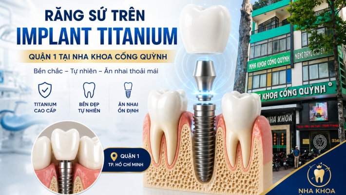 Răng sứ trên Implant Titanium Quận 1 tại Nha Khoa Cống Quỳnh