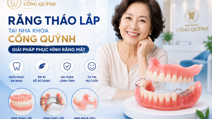 Răng tháo lắp tại Nha Khoa Cống Quỳnh – Giải pháp phục hình răng mất